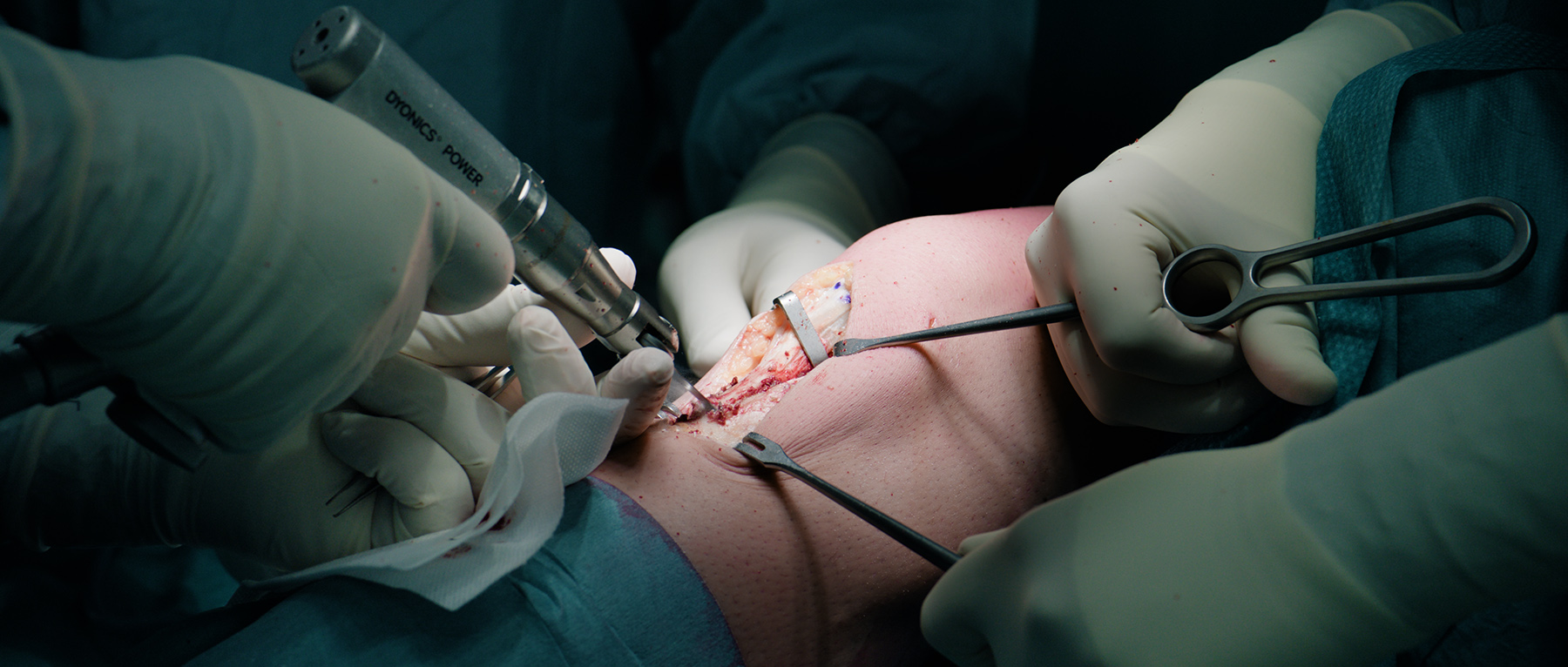 Agon - Fiction documentée